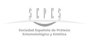 sepes