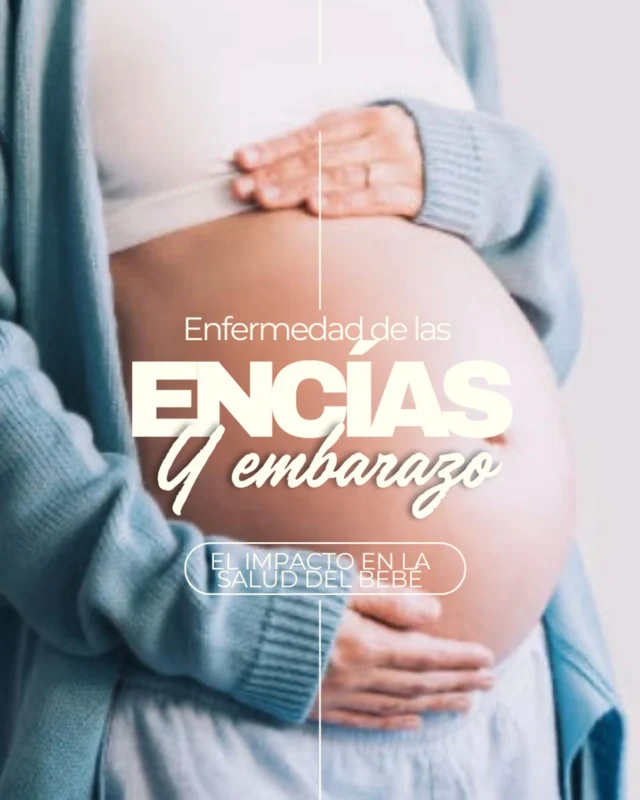📣¿Sabías que la salud de tus encías puede afectar a tu embarazo?🤰🦷

La enfermedad periodontal no solo afecta a tu boca…también puede aumentar el riesgo de:

⚠️Parto prematuro
⚠️Bajo peso al nacer
⚠️Preclampsia

Esto ocurre porque las bacterias y la inflamación en las encías pueden llegar al torrente sanguíneo y afectar al bebé.

✨¿La buena noticia?
¡El tratamiento periodontal es seguro durante el embarazo y puede ayudarte a tener un embarazo más saludable!

🔍 Consúltanos si estás embarazada o planeas estarlo. Tu salud oral también cuenta.

#saludperiodontal #embarazosaludable #odontología #ginecologia #prevencion #partoprematuro #saludmaternofetal #periodoncia #preclampsia #mamasaludable #vallesvallesclinicadental